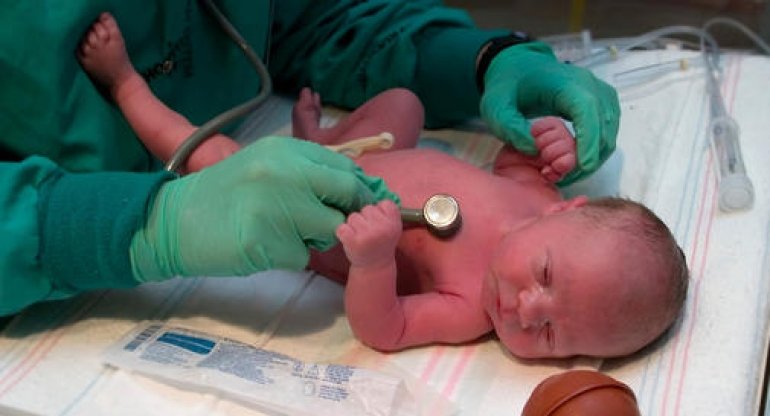 Серцеві шуми у новонароджених