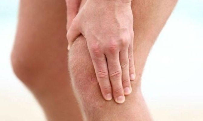 Як лікувати артроз колінного суглоба медикаментозне лікування