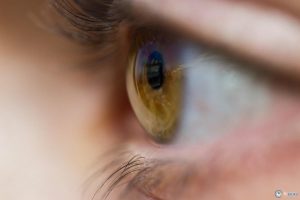 Вторинна катаракта: причини, симптоми, лікування, профілактика