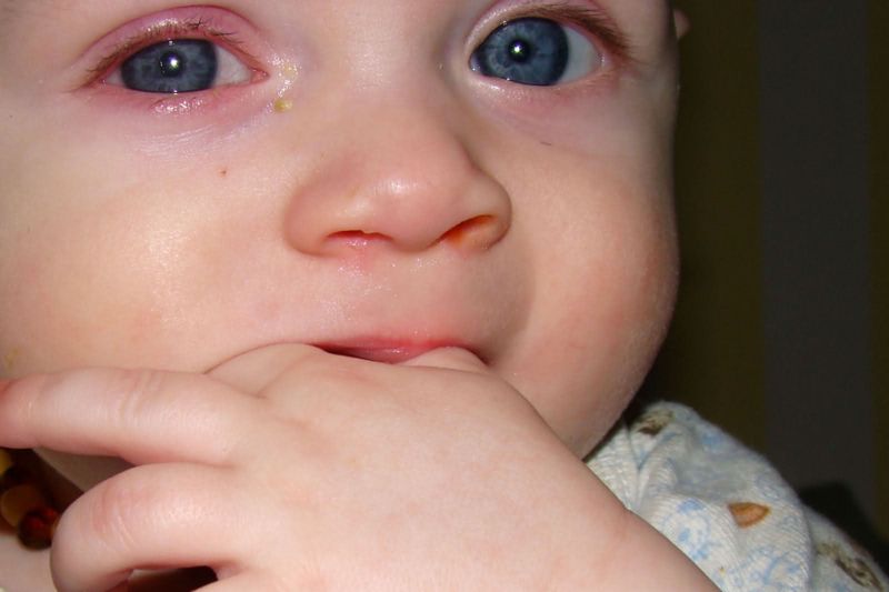 Що робити, якщо у дитини почервоніли очі: причини і лікування, супутні симптоми й профілактика