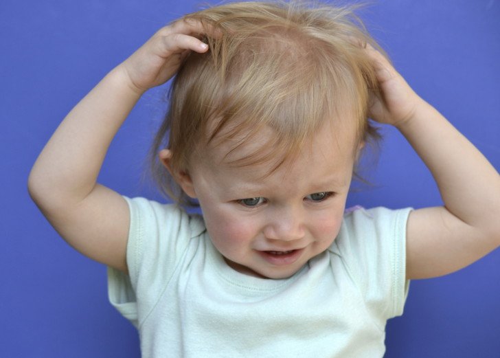 Що робити, якщо у дитини сильно випадає волосся: в чому причина і є ефективне лікування?