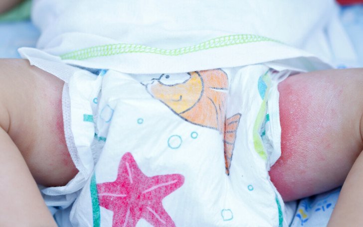 Причини підвищення кількості лейкоцитів в сечі у немовлят і норма показника у дитини