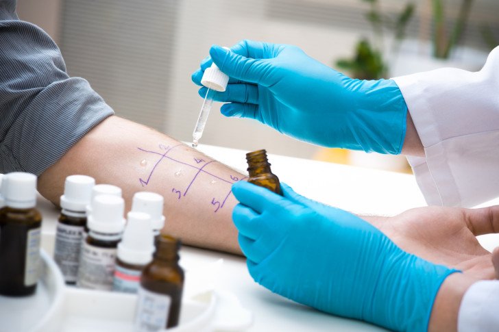 Алергопроби для дитини: аналізи крові, провокаційний тест і шкірні проби для виявлення алергену