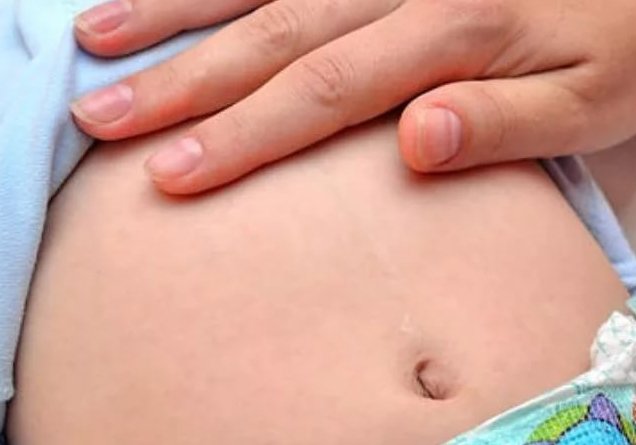 Болить живіт у новонародженого немовляти Чому у новонароджених часто: болі в животі у немовляти після годування, що робити