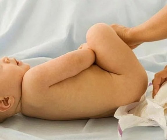 Пронос і діарея у новонародженого немовляти Що робити і як виглядає пронос у дитини