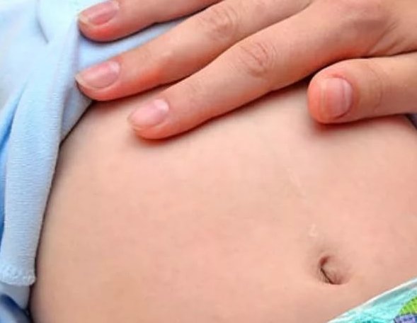 Коліки у новонароджених лікування в домашніх умовах Народні засоби від кольок у немовлят