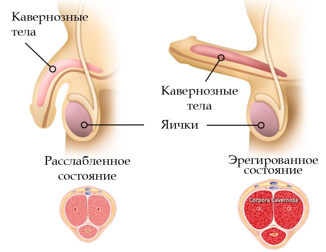 Атеросклероз судин статевого члена – причини і лікування