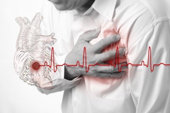 Невроз серця: симптоми і лікування народними засобами