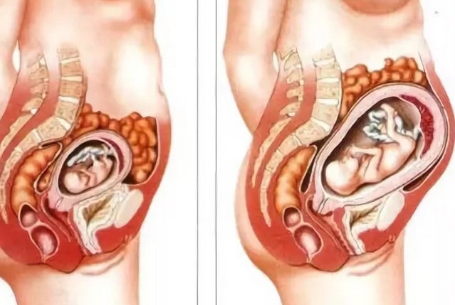 Тягне низ живота на 7 тижні вагітності Тягне живіт коли вагітність