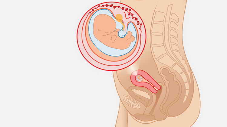 9 тиждень вагітності (1 й триместр) — мама і малюк