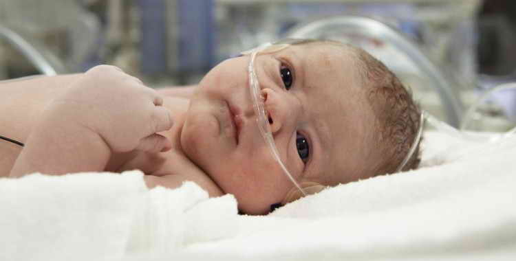 Асфіксія новонароджених: причини, лікування, профілактика