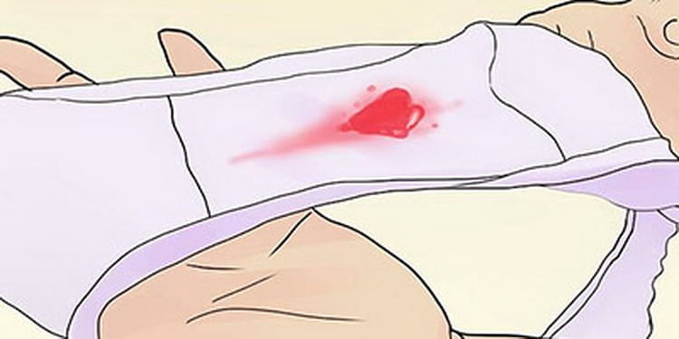 Що означають кровянисті виділення при вагітності