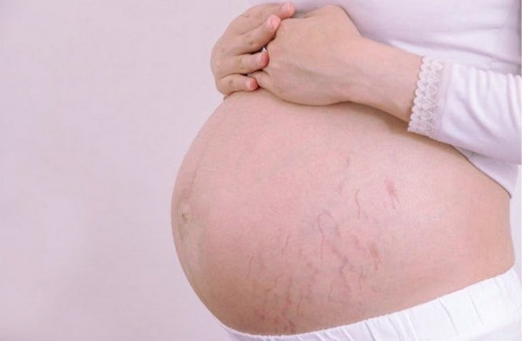 Елевіт Пронаталь – вітаміни для вагітних і плануючих вагітність