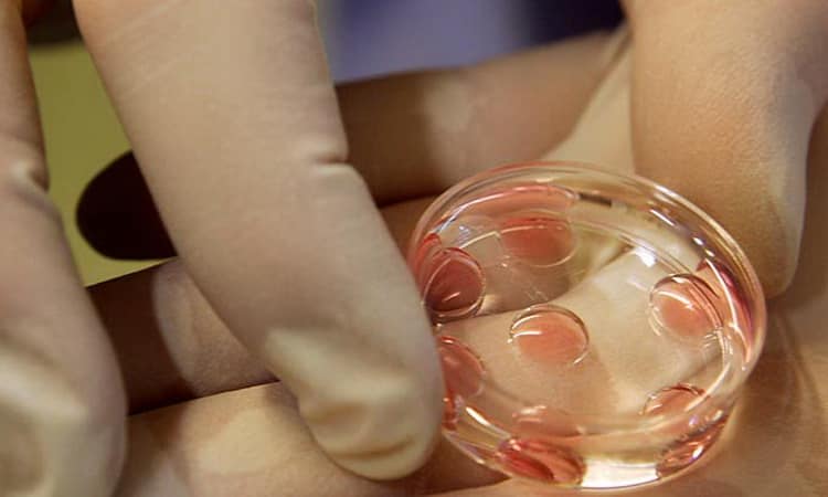 Перенесення ембріонів при ЕКО: як відбувається диво