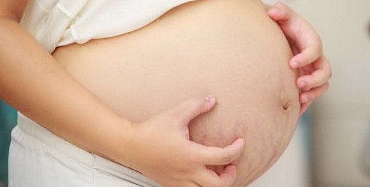 Свербить живіт при вагітності: причини