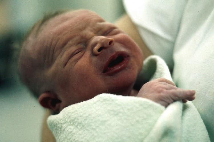Гемолітична хвороба новонароджених: симптоми і лікування