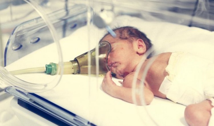 Гіпоксія у новонароджених: наслідки для дитини