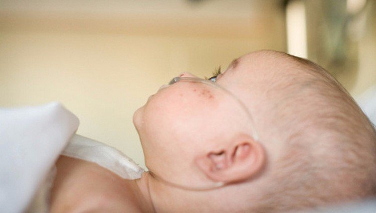 Порок серця у новонароджених: причини і наслідки