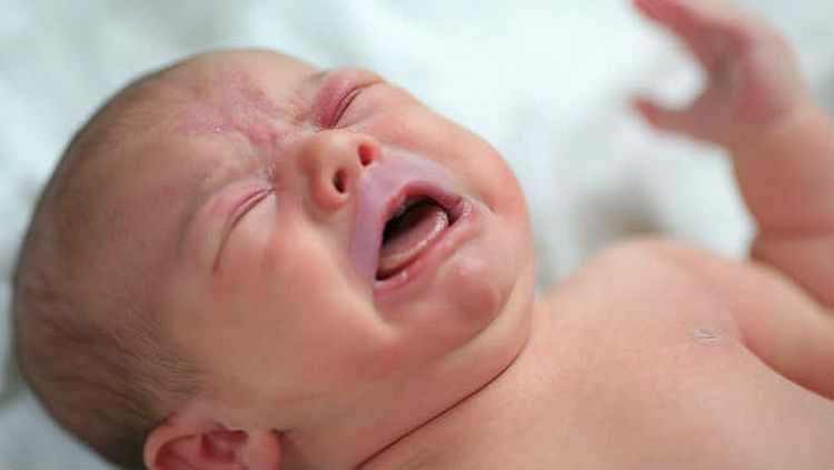 Порок серця у новонароджених: причини і наслідки