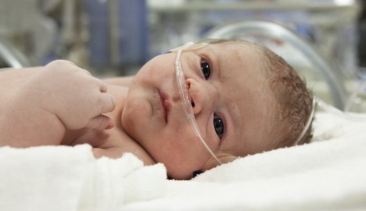Сепсис у новонароджених: симптоми і лікування