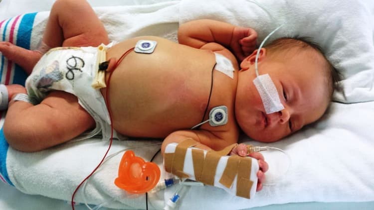 Сепсис у новонароджених: симптоми і лікування