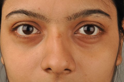 Маска для шкіри навколо очей очей: фото та відео