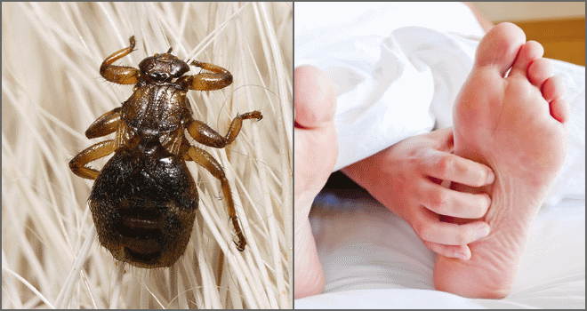Блоха людська: особливості комахи, небезпека укусів, способи винищення