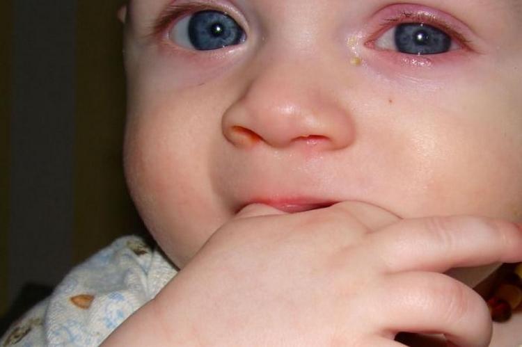 Очні краплі Левоміцетин для дітей: відгуки та інструкція