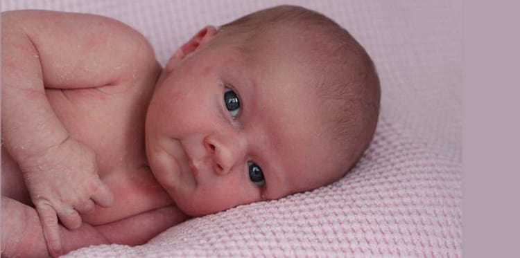 Мармурова шкіра у малюка: чи варто турбуватися