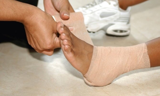 Що робити при розтягуванні звязок ноги?