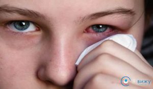 Опух очей (з за алергії, опухло повіку, сильно опухло навколо очей і під оком) що робити?