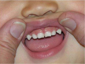 Порядок появи молочних зубів у малюка
