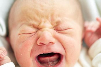 Як визначити, що у немовляти коротка вуздечка мови?