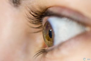 Закритокутова глаукома: причини виникнення захворювання, лікування, профілактика