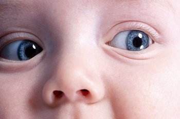 Що таке дакріоцистит у немовляти, і як його лікувати?