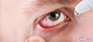 Червоні судини на білках очей причини, наслідки, лікування (краплі, компрес, фото)