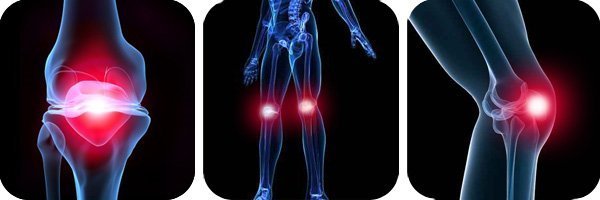 Хвороба шляттера колінного суглоба: лікування