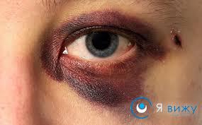 Розшарування сітківки ока причини, симптоми, лікування (варіанти операції, ціна)