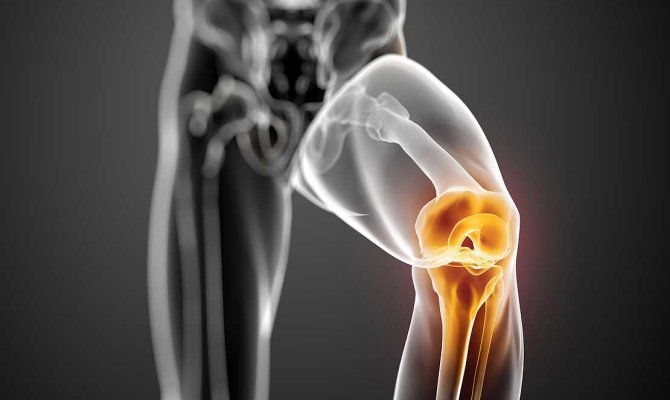 Хвороба Гоффа колінного суглоба: лікування