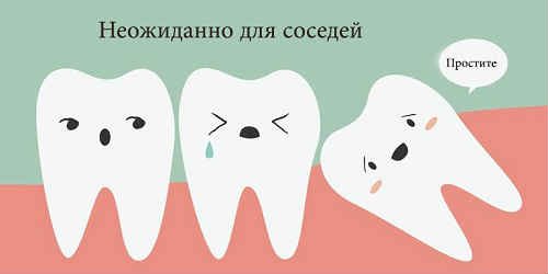 Зуби мудрості — потрібно видаляти або варто залишити