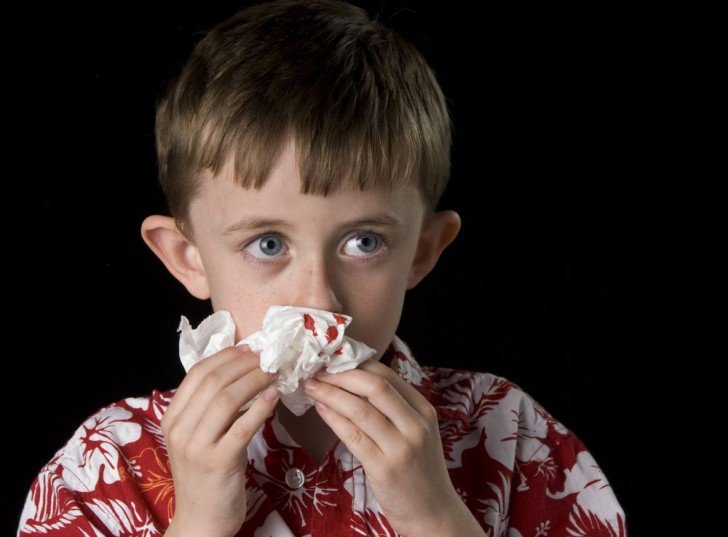 Чому у дитини з носа йде кров: причини і лікування носової кровотечі в домашніх умовах