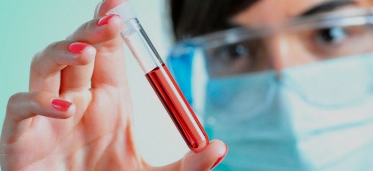 Розшифровка результатів біохімічного аналізу крові у дітей: показники норм і відхилень у таблиці