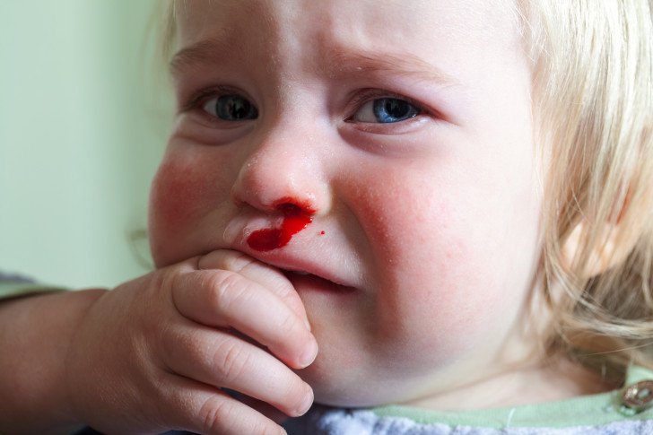 Чому у дитини знижений рівень тромбоцитів у крові, про що це говорить: причини і наслідки