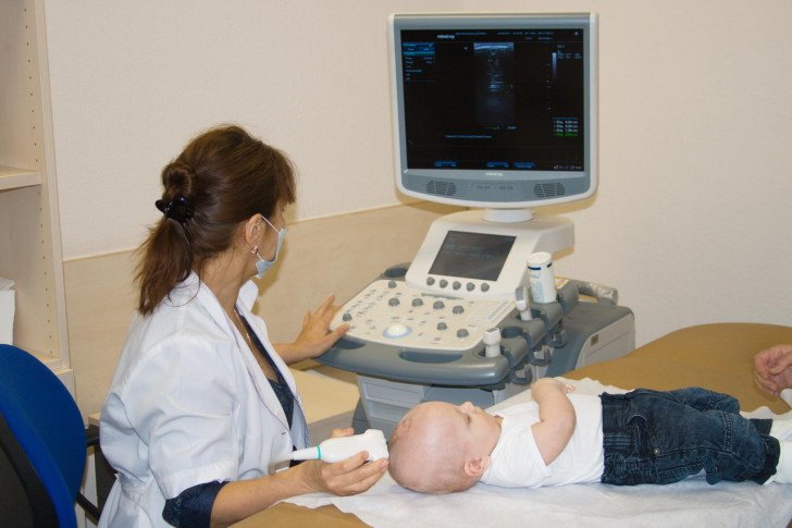 Що показує НСГ головного мозку (нейросонографія) у новонароджених і дітей до року: розшифровка УЗД