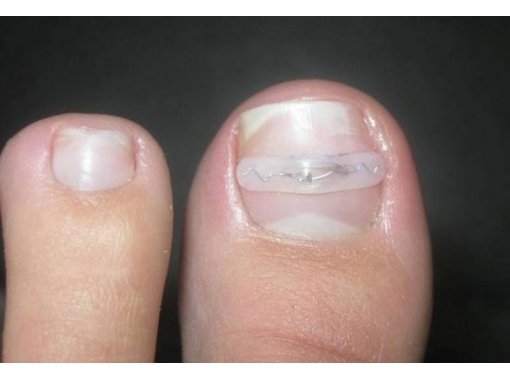 Що таке нігті? Склад і будова нігтів на руках людини . З чого складаються нігті