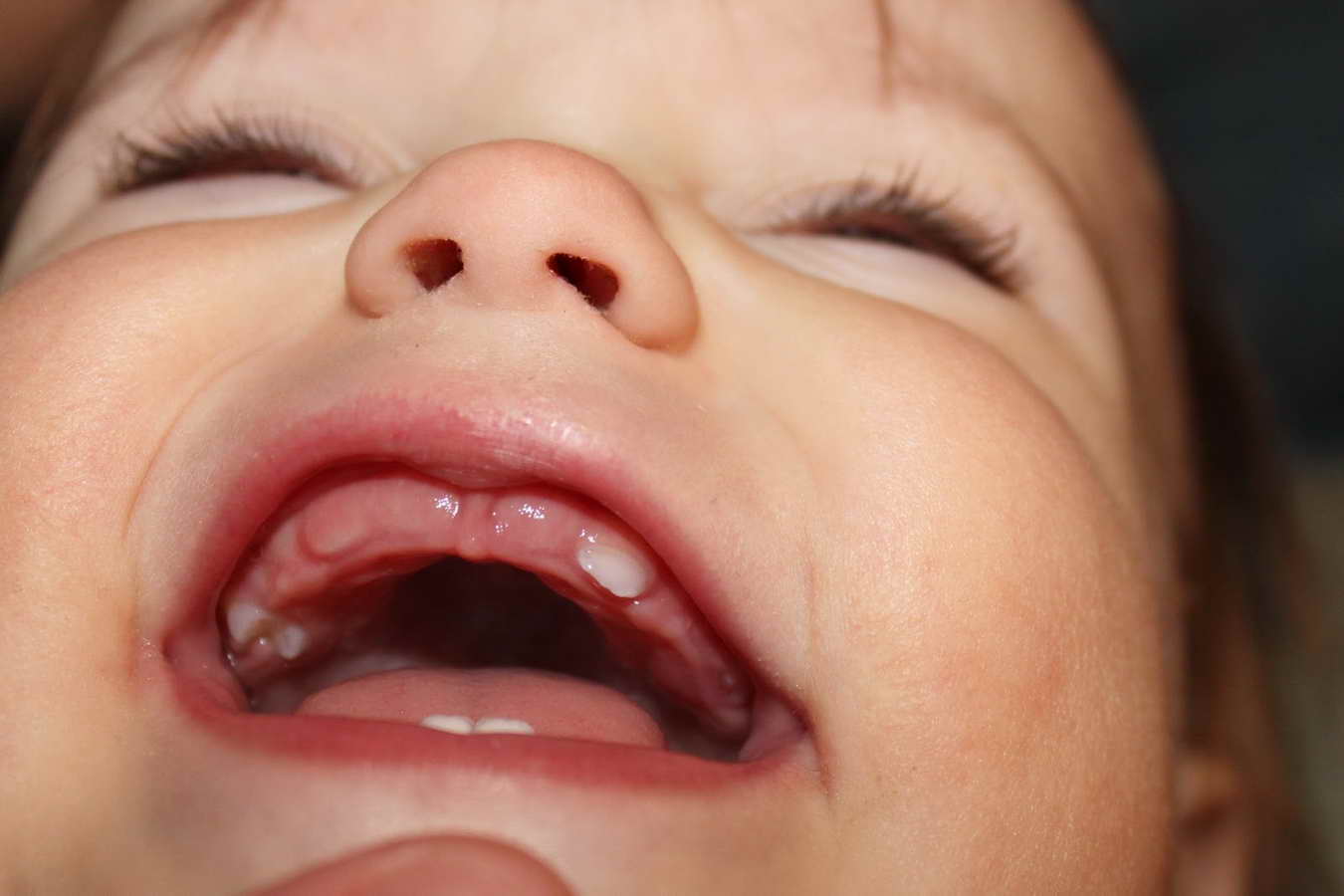 Терміни та порядок прорізування молочних зубів у немовлят та дітей до 3 років: таблиця і графік зростання