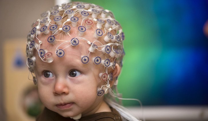 Що показує ЕЕГ головного мозку у дитини: норми, розшифровка результатів та порушення на енцефалограмі