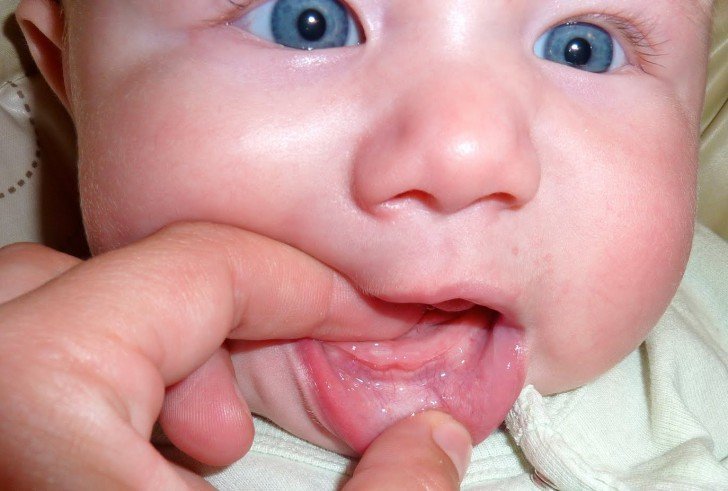 Чому у немовляти або дитини старше року пахне ацетоном з рота: причини та способи лікування