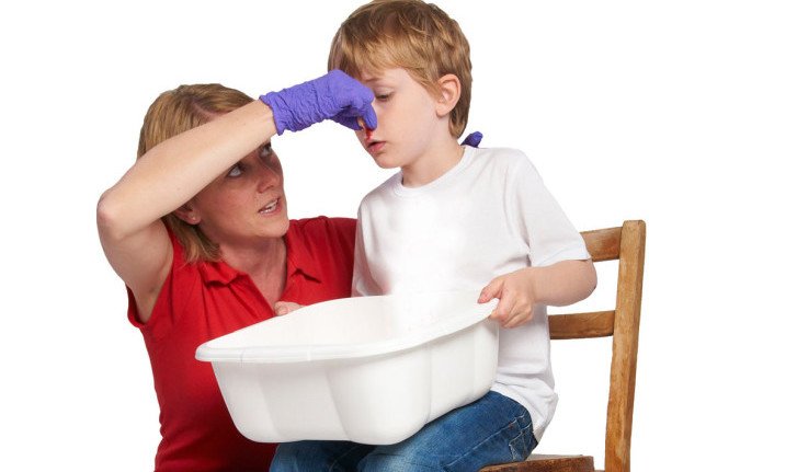 Чому у дитини з носа йде кров: причини і лікування носової кровотечі в домашніх умовах