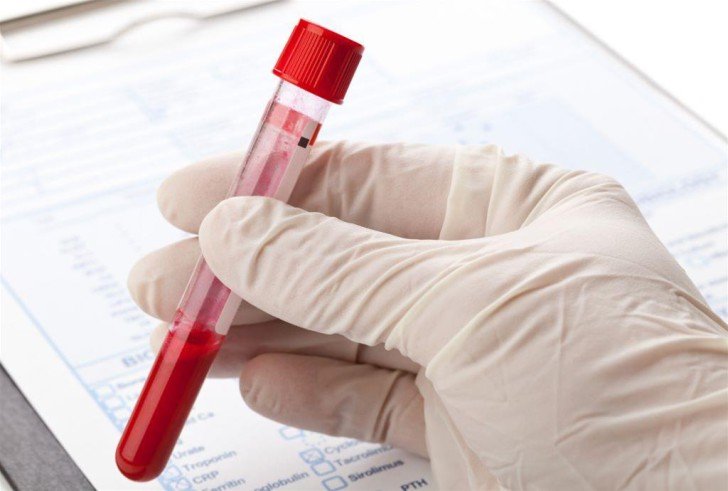 Розшифровка лейкоцитарної формули крові у дітей і норма вмісту клітин в таблиці
